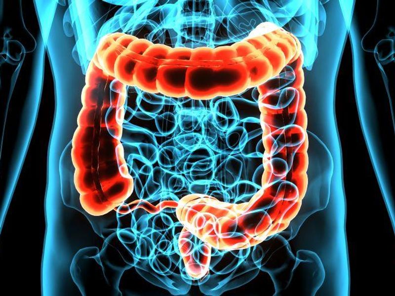 Factors Associated With a DAMA from an ED in Adult Patients With Appendicitis