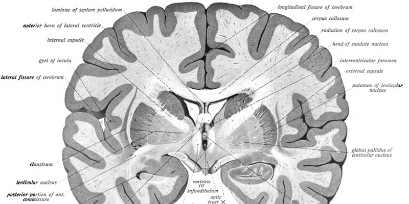 CAR-T Cell Therapy for Relapsed or Refractory High-Risk Neuroblastoma