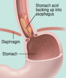 Tislelizumab for advanced esophageal squamous cell carcinoma