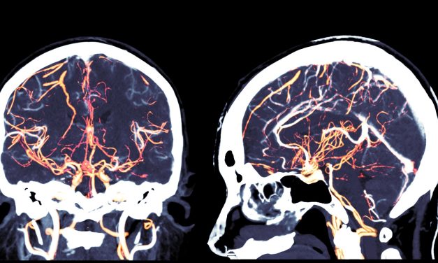 Decrease in Head and Neck Cancer Incidence Seen During Pandemic