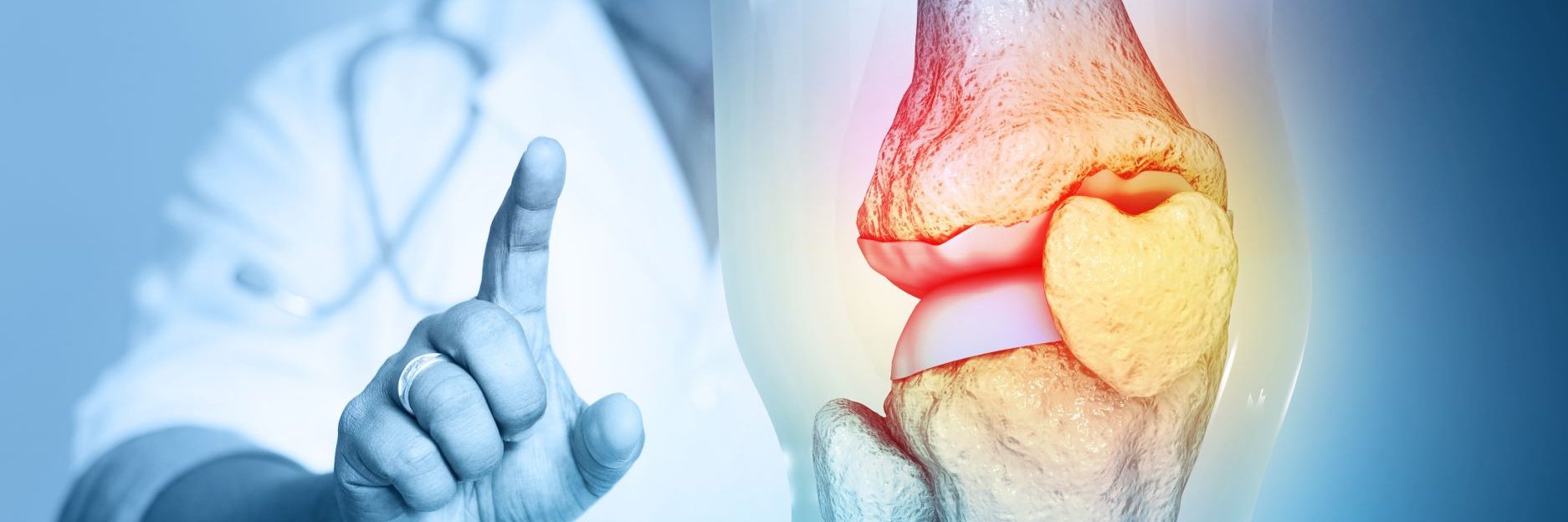 Impact of Ultra-Early Physical Therapy on Total Knee Arthroplasty Outcomes