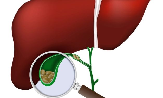 Social Deprivation Index Identifies Disparities in Liver Transplant