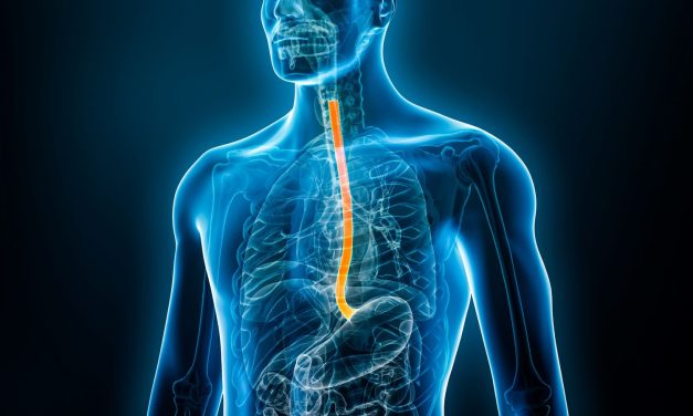 Retrograde Cricopharyngeus Dysfunction Often Not Discussed With PCPs