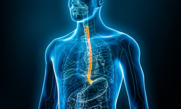 GERD Can Induce Occurrence of RA, but Not Vice Versa