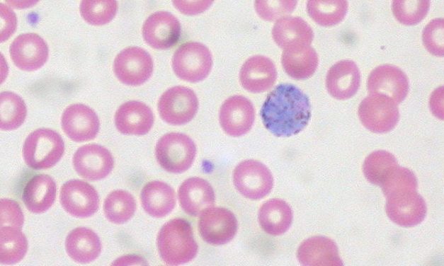 Radical cure with primaquine reduces risk of Plasmodium vivax parasitaemia in patients with Plasmodium falciparum infection