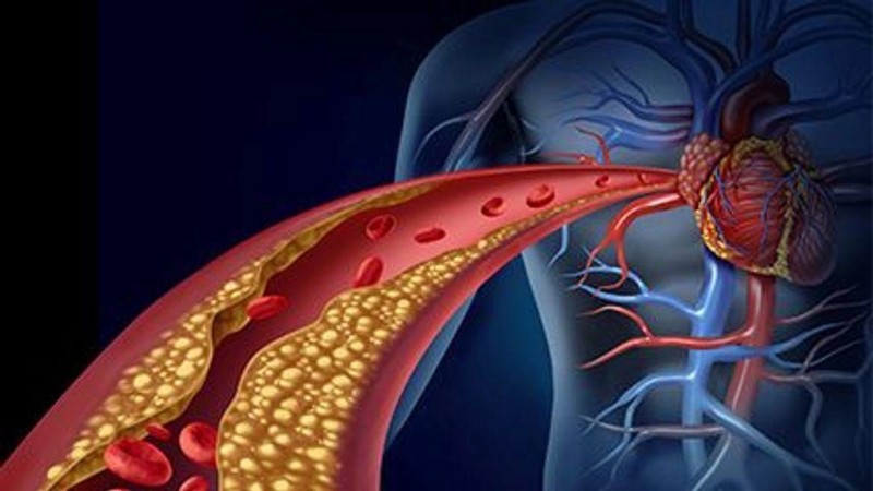 Coronary Artery Disease Testing After Initial Heart Failure Hospitalization Aids Outcomes