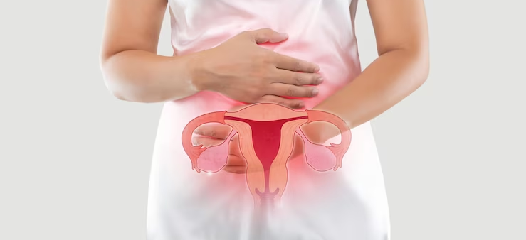 Hysterectomy Patterns & Complications Post-Laparoscopic Cervical Cancer Surgery