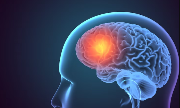 Comparing 0.9% Saline Traumatic Brain Injury and Isotonic Balanced Fluid