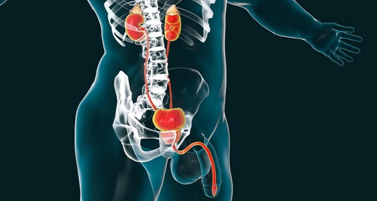 Assessing the Impact of RC on Clinically Node Positive Bladder Cancer