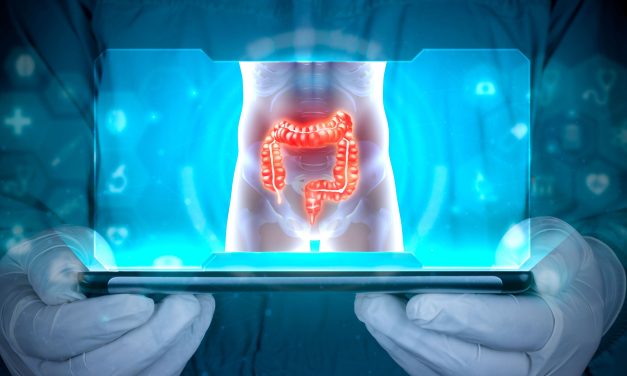 Optimizing Fecal Calprotectin Cutoffs for Assessing UC Endoscopic Activity