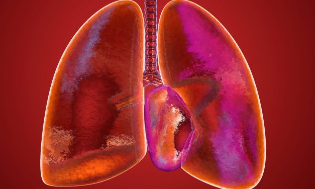 Low-Dose CT Screening Superior to Chest Radiography