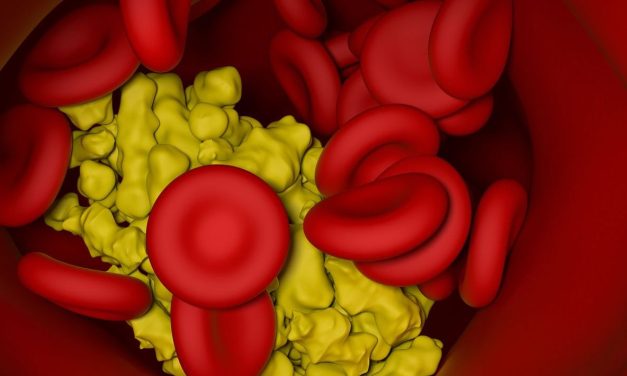 Increased Lipoprotein(a) Levels Heritable Among First-, Second-Degree Relatives