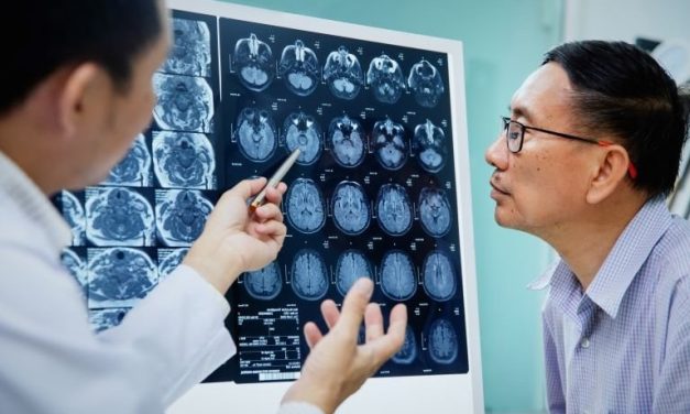 Silent Brain Infarct, Cerebral Small Vessel Disease Prevalent in Heart Disease