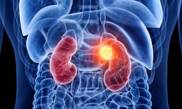 Improvement Seen in Survival With Adjuvant Pembrolizumab in Kidney Cancer